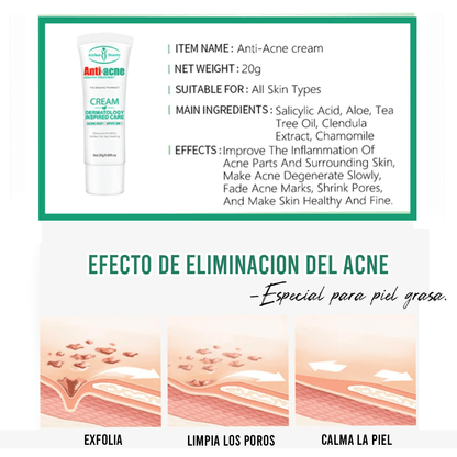 Aichun Beauty®- Crema anti-acné ¡Renueva tu Piel, dile adiós al acné!✨🍃